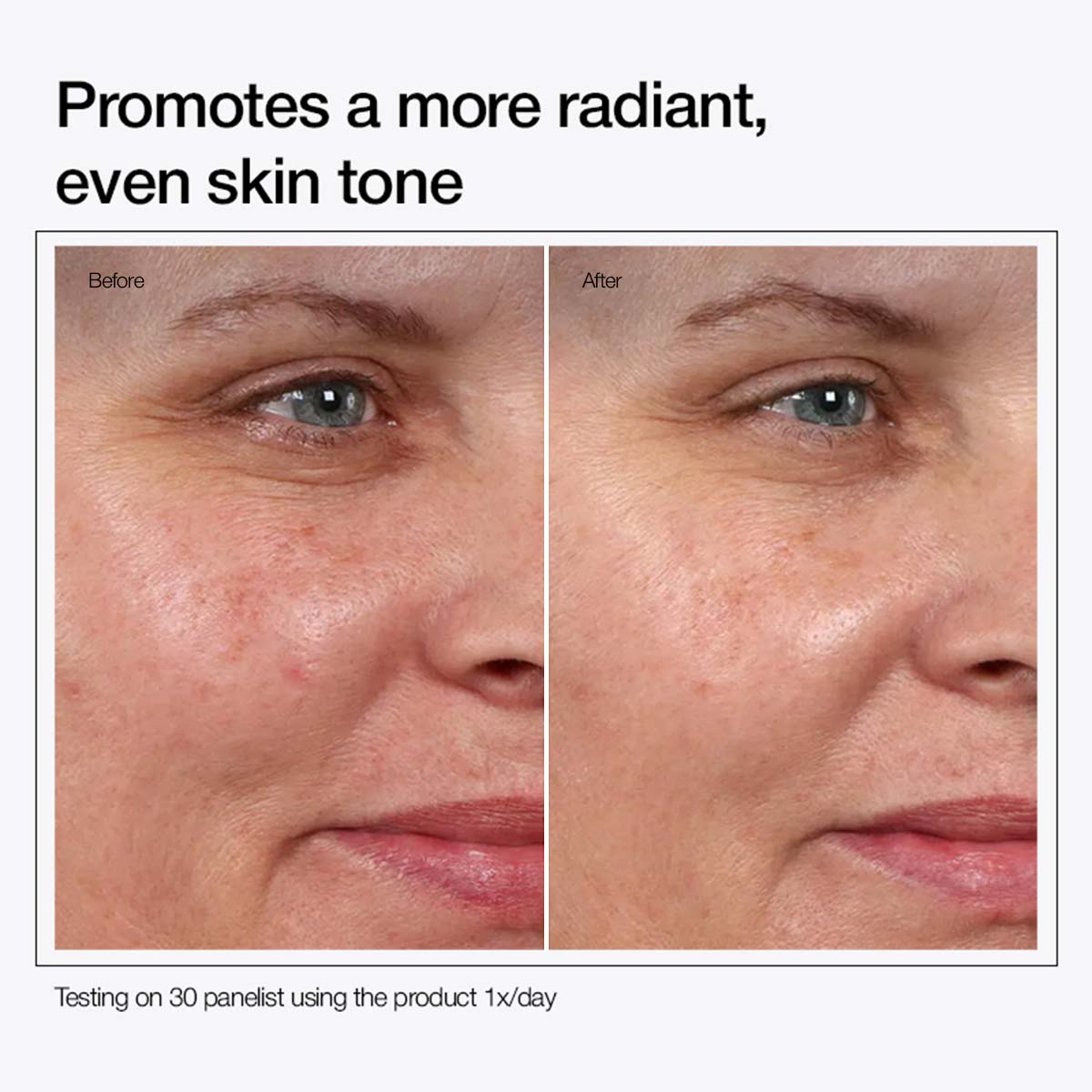 Glycolic Acid 7% Toning Solution( buy 1 get 2 free )