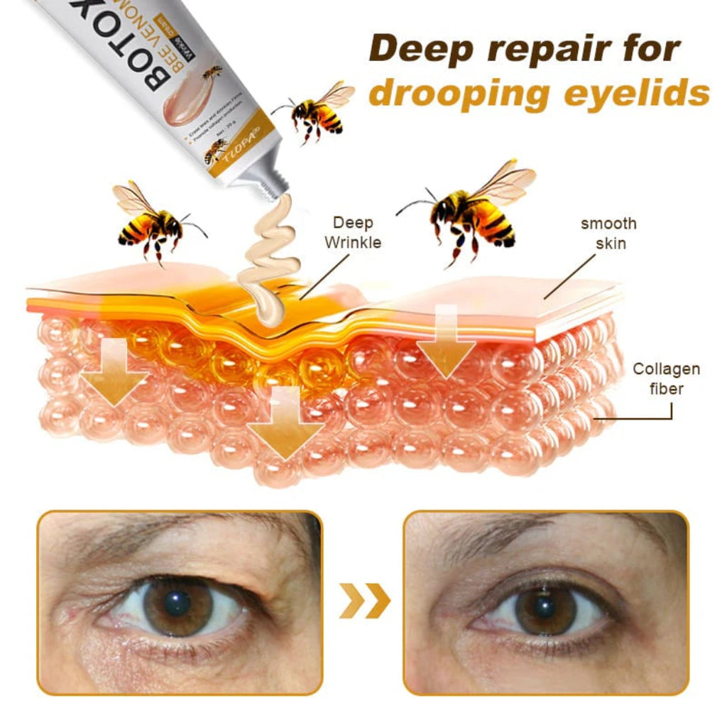 Botox Bee Venom Wrinkle Removal Cream ( Buy 1 Get 1 Free )